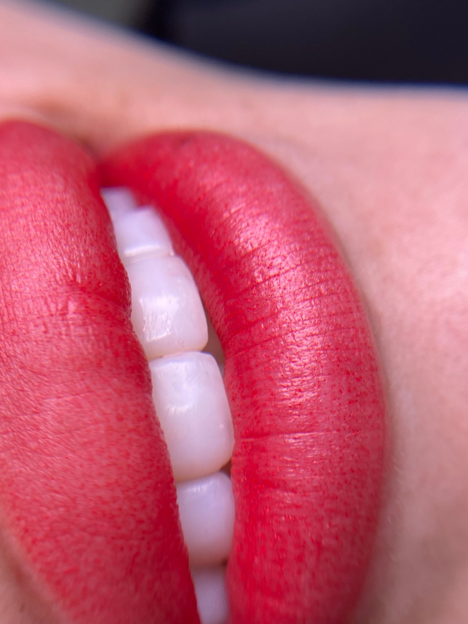 Resultado de micropigmentação labial 1